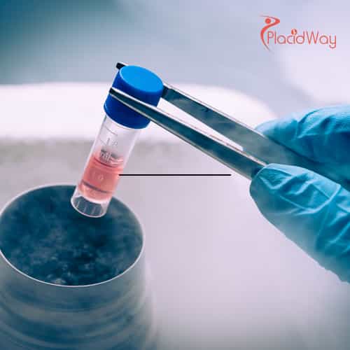 Stem Cell Therapy for Joint Pain in Thailand: Advanced Healing Options for Australian Patients
